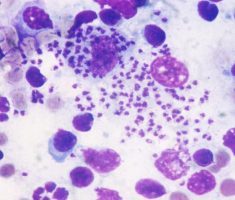 Leishmania Infantum