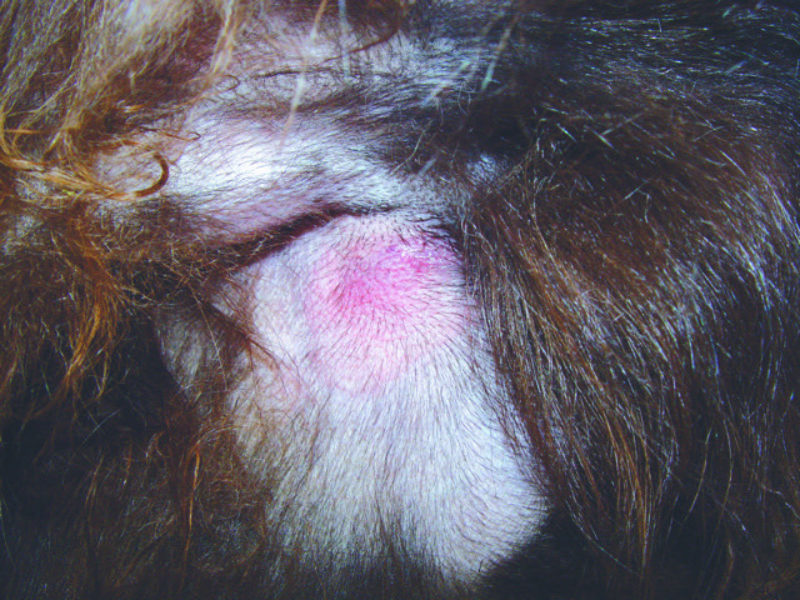 Tick dermatitis