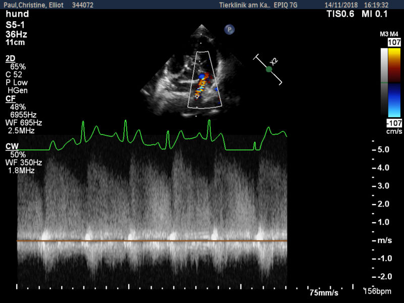 Pda Im Spektraldoppler